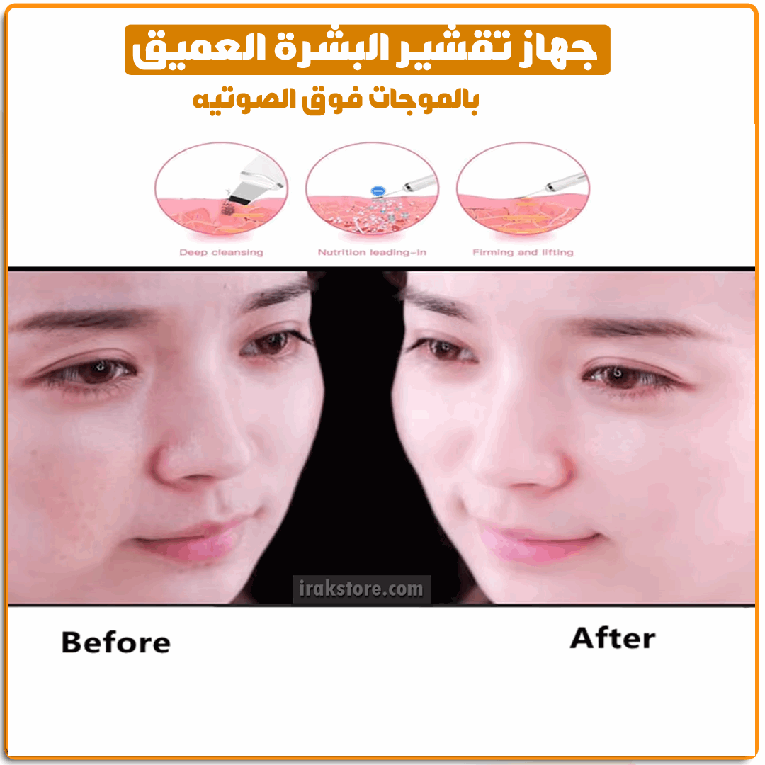 جهاز تقشير الوجه بالموجات فوق الصوتية - الصورة 4